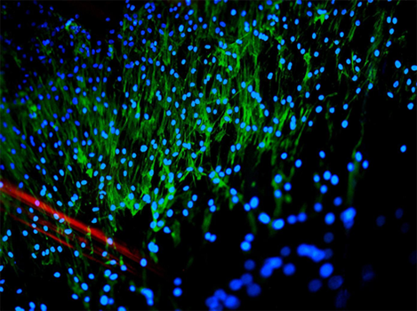 Human Progenitor Cells