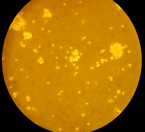Raji Cells