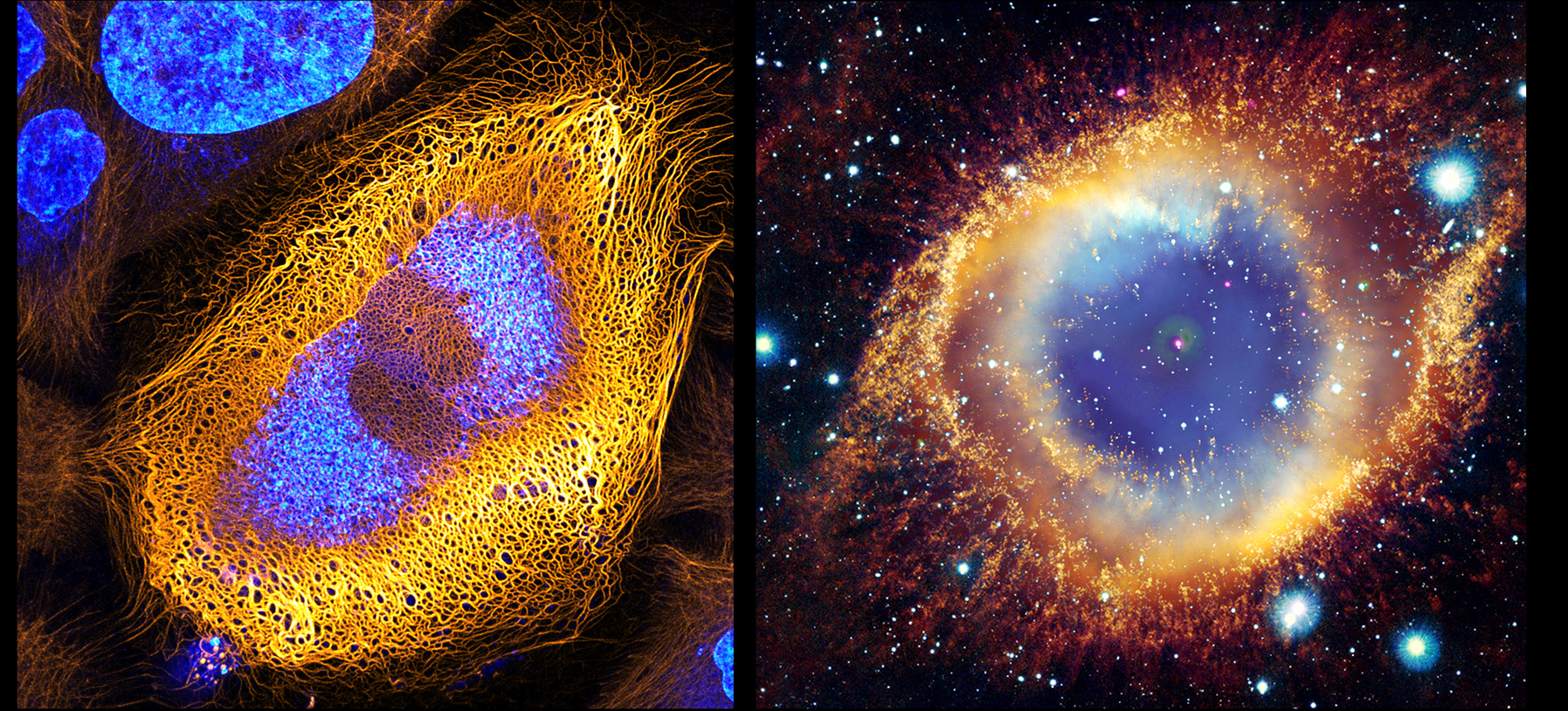 Lab Skin Cells  vs. Planetary Nebula