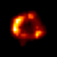 Photo of Supernova 1987A