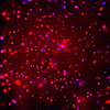 X-ray Image Zoom