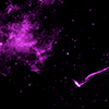 X-ray image